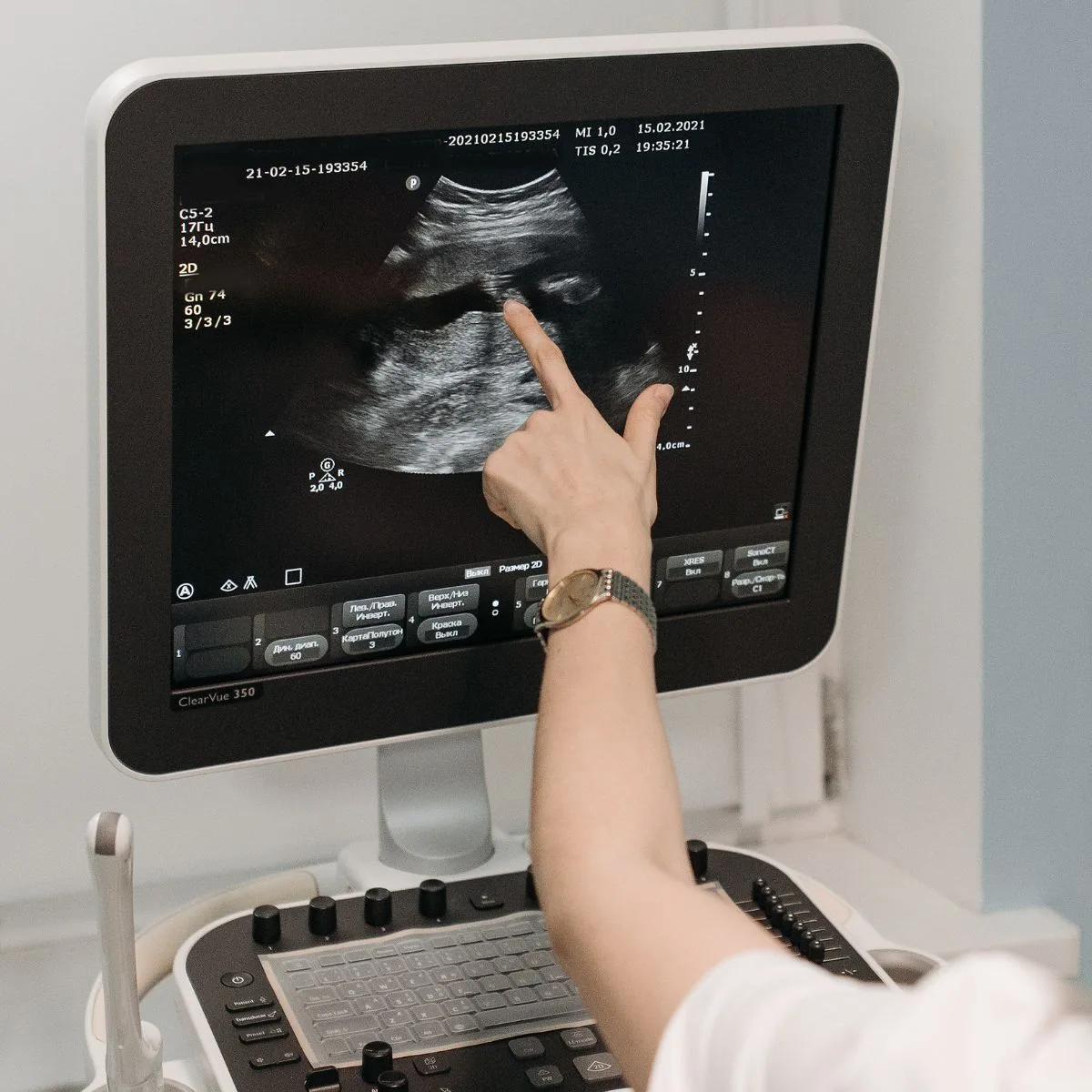 Annex Medical Imaging - Ultrasound