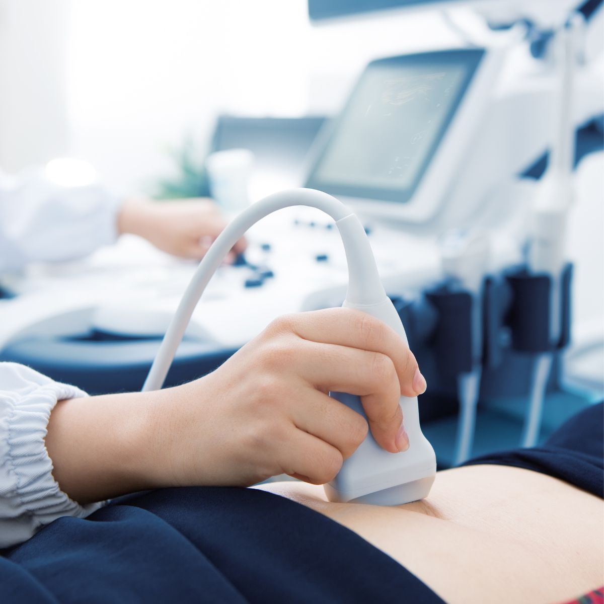Ultrasound machine and probe used for vascular Doppler studies at Annex Medical Imaging
