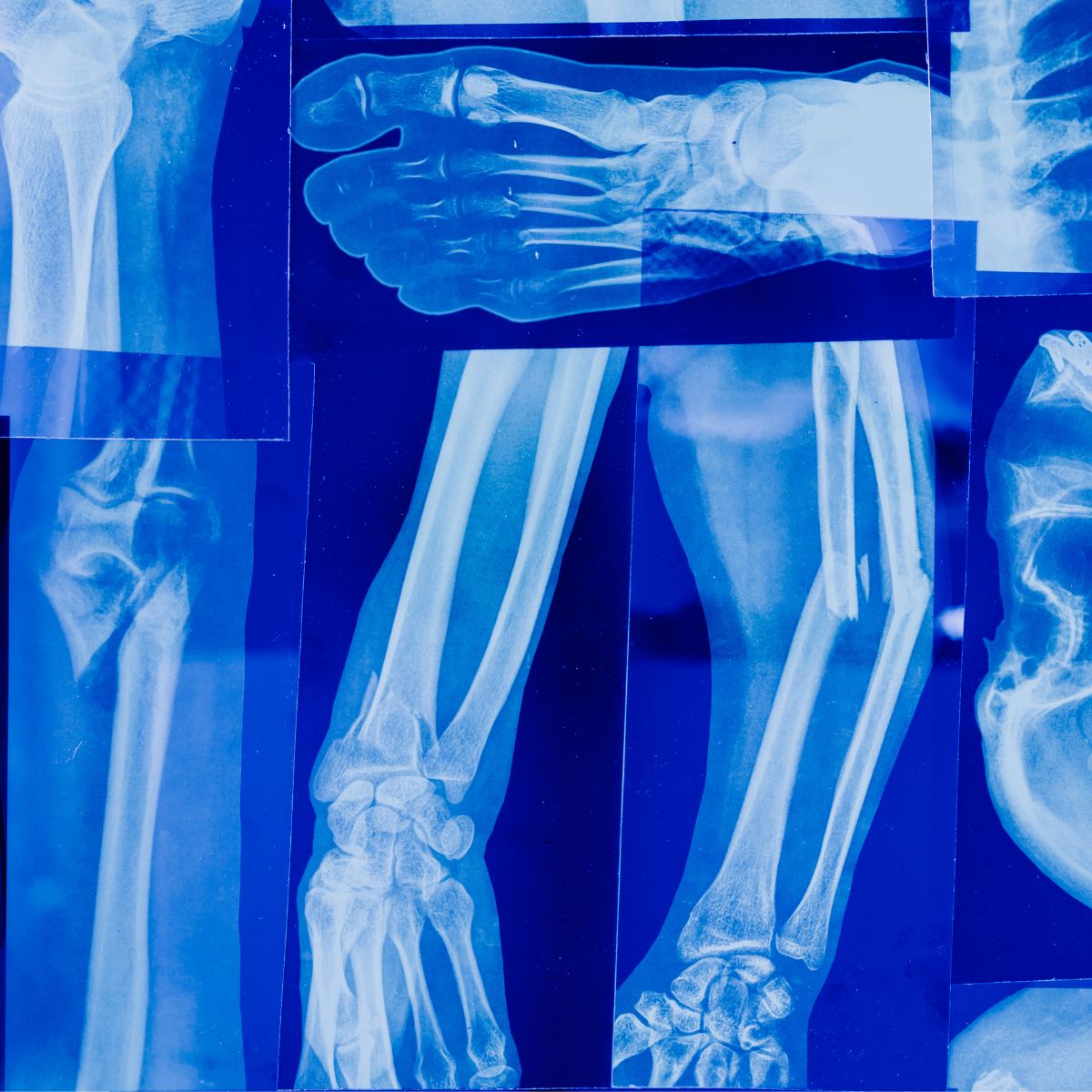 Collage of joint and limb X-ray films at Annex Medical Imaging