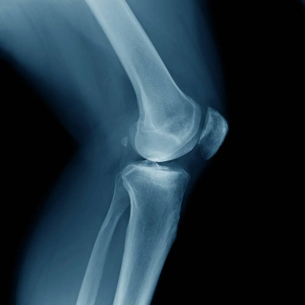 annex-medical-imaging -blog